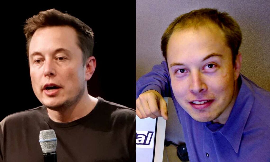 Elon Musk's Plastic Surgery Did The Twitter CEO Ungergo Sugery?