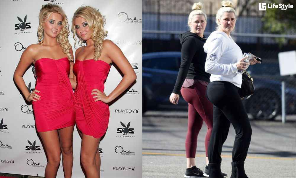 Shannon Twins Weight Gain - Did They Undergo Surgery?
